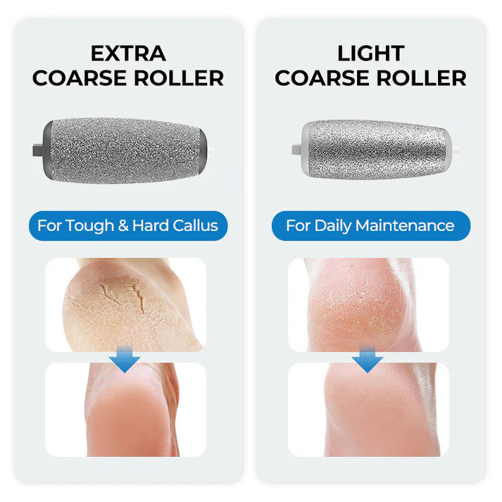 ⚡Electric Feet Callus Remover