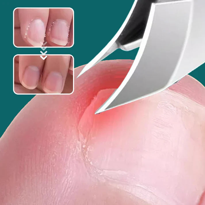 छ्याँक नउड्ने २५° ढल्किएको धार भएको नङ कटर ३ टुक्रे सेट